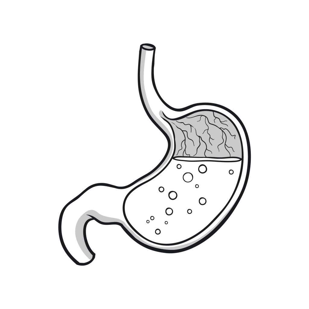 hipoclorhidria tratamiento