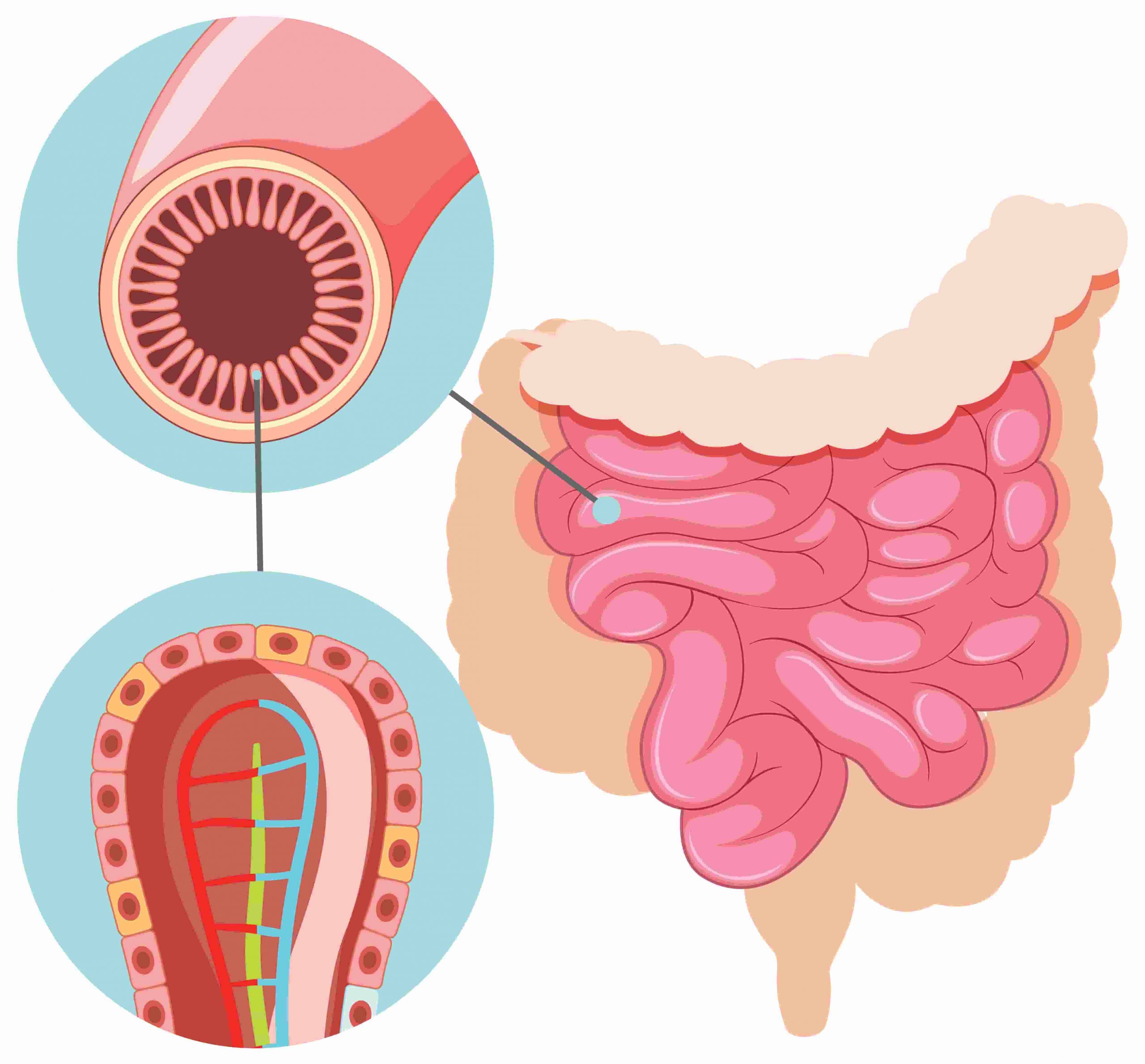 tratamiento para la permeabilidad intestinal natural