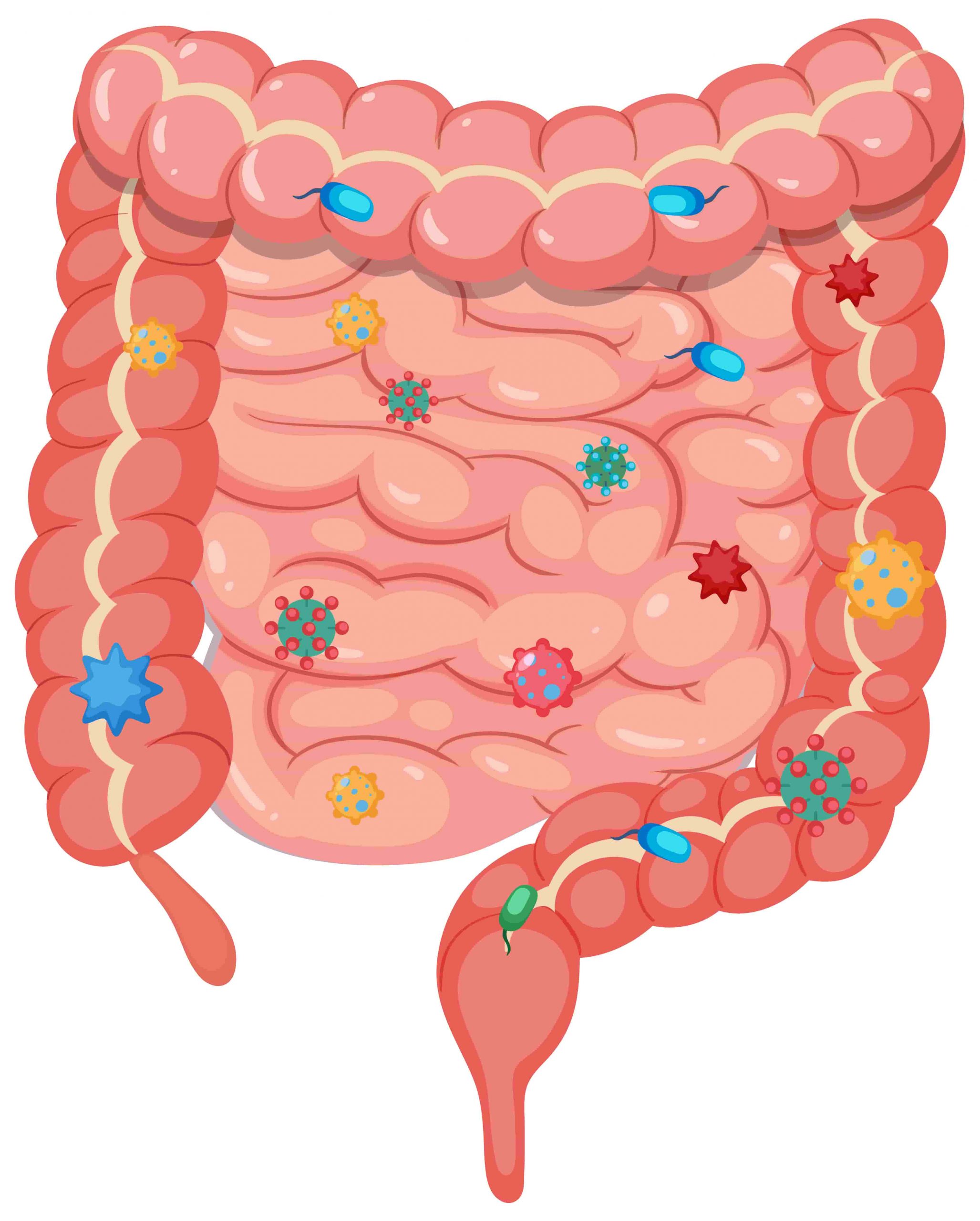 Tratamiento disbiosis intestinal